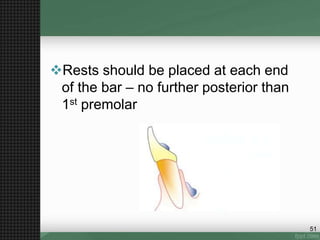 Rests should be placed at each end
of the bar – no further posterior than
1st premolar
51
 