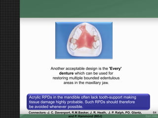 Another acceptable design is the 'Every'
denture which can be used for
restoring multiple bounded edentulous
areas in the maxillary jaw.
Acrylic RPDs in the mandible often lack tooth-support making
tissue damage highly probable. Such RPDs should therefore
be avoided whenever possible.
64Connectors -J. C. Davenport, R.M.Basker, J. R. Heath, J. P. Ralph, PO. Glantz,
and P. Hammond (BDJ)
 