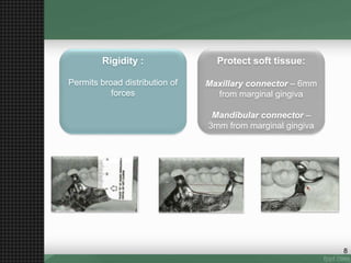 Rigidity :
Permits broad distribution of
forces
Protect soft tissue:
Maxillary connector – 6mm
from marginal gingiva
Mandibular connector –
3mm from marginal gingiva
8
 