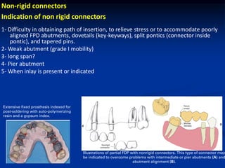 Comprehensive Guide to Soldering and Connectors in Fixed Partial ...