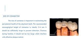 CONNECTORS AND SOLDERS IN FIXED DENTAL PROSTHESIS | PPTX