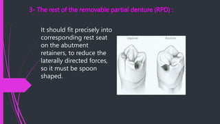 Rest In Rpd CONNECTORS in fixed prosthodontics ( Rig) | PPTX
