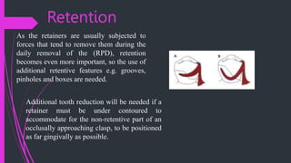 CONNECTORS in fixed prosthodontics ( Rig) | PPTX
