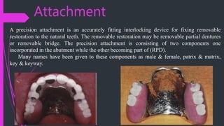 Internal Attachment Rpd CONNECTORS in fixed prosthodontics ( Rig) | PPTX