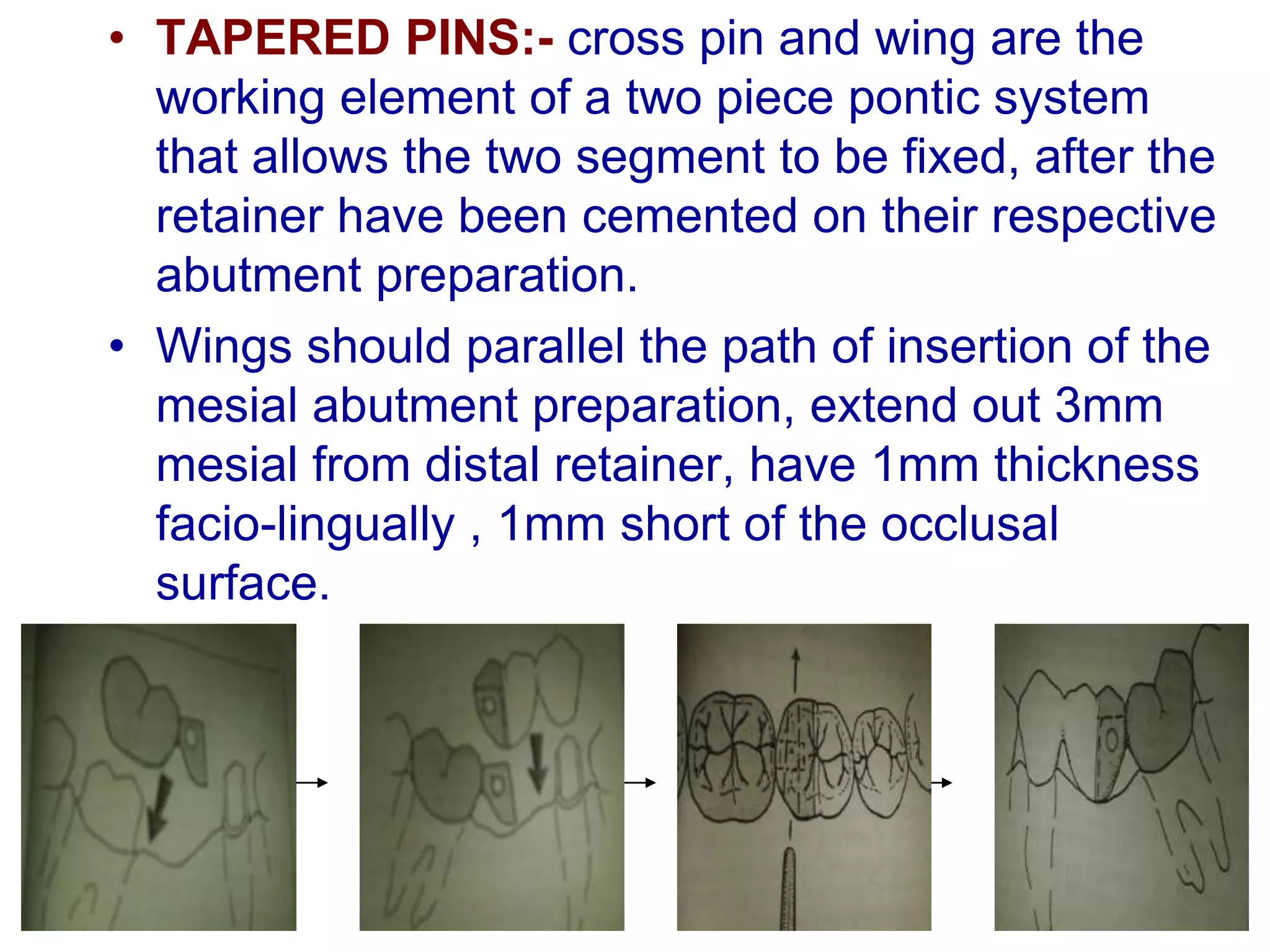 • TAPERED PINS:- cross pin and wing are the
working element of a two piece pontic system
that allows the two segment to be fixed, after the
retainer have been cemented on their respective
abutment preparation.
• Wings should parallel the path of insertion of the
mesial abutment preparation, extend out 3mm
mesial from distal retainer, have 1mm thickness
facio-lingually , 1mm short of the occlusal
surface.
 