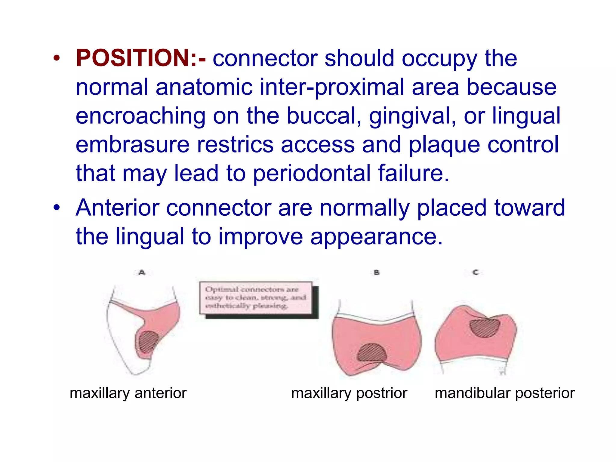 • POSITION:- connector should occupy the
normal anatomic inter-proximal area because
encroaching on the buccal, gingival, or lingual
embrasure restrics access and plaque control
that may lead to periodontal failure.
• Anterior connector are normally placed toward
the lingual to improve appearance.
maxillary anterior maxillary postrior mandibular posterior
 