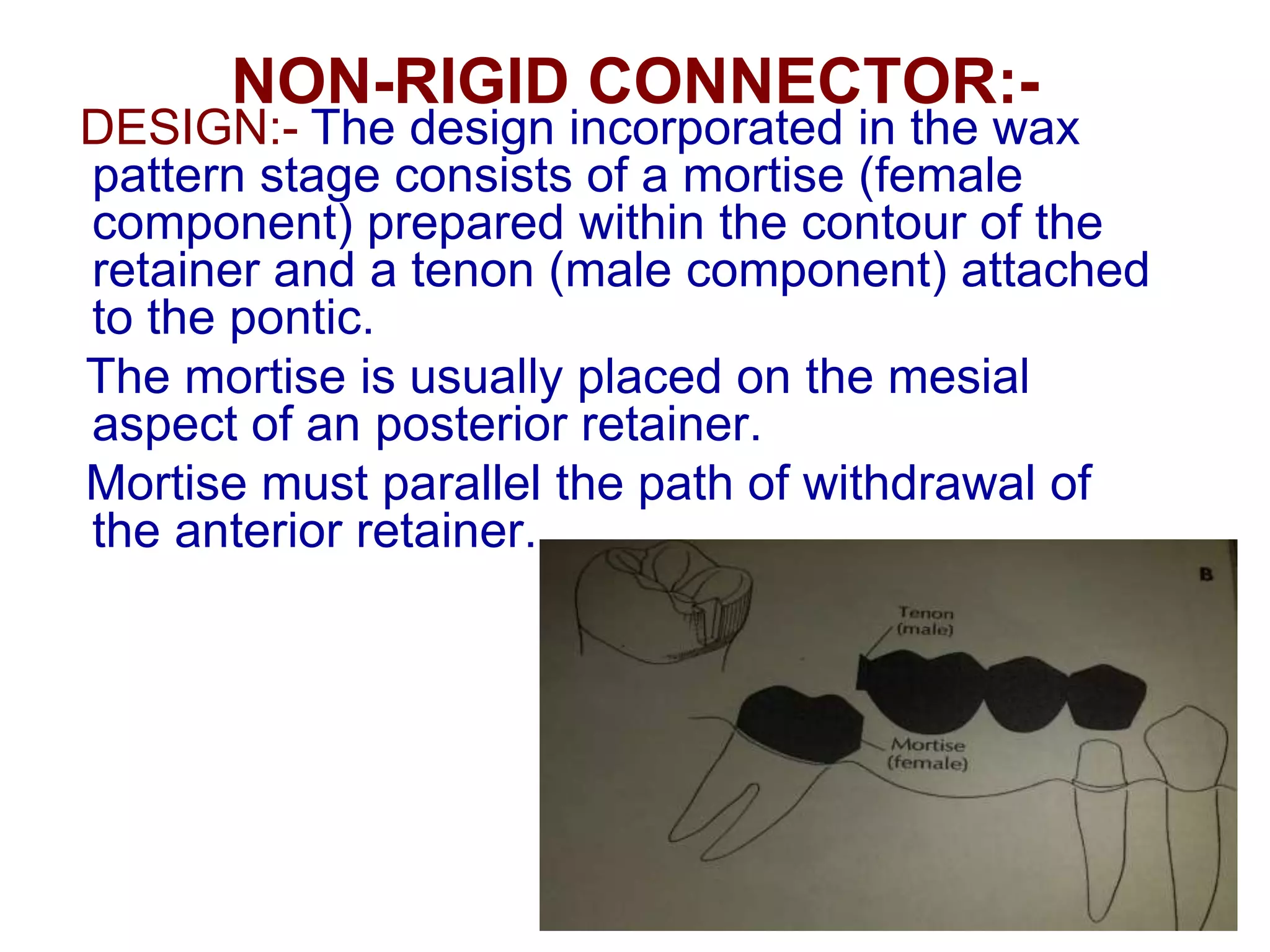NON-RIGID CONNECTOR:-
DESIGN:- The design incorporated in the wax
pattern stage consists of a mortise (female
component) prepared within the contour of the
retainer and a tenon (male component) attached
to the pontic.
The mortise is usually placed on the mesial
aspect of an posterior retainer.
Mortise must parallel the path of withdrawal of
the anterior retainer.
 