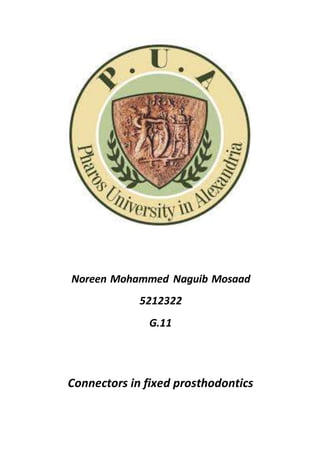 Noreen Mohammed Naguib Mosaad
5212322
G.11
Connectors in fixed prosthodontics
 