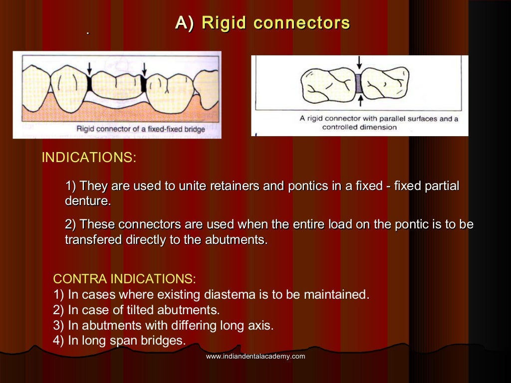 Connectors in fpd continued dental education