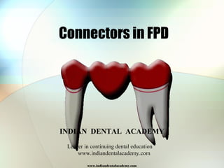 Connectors in FPD
www.indiandentalacademy.com
INDIAN DENTAL ACADEMY
Leader in continuing dental education
www.indiandentalacademy.com
 