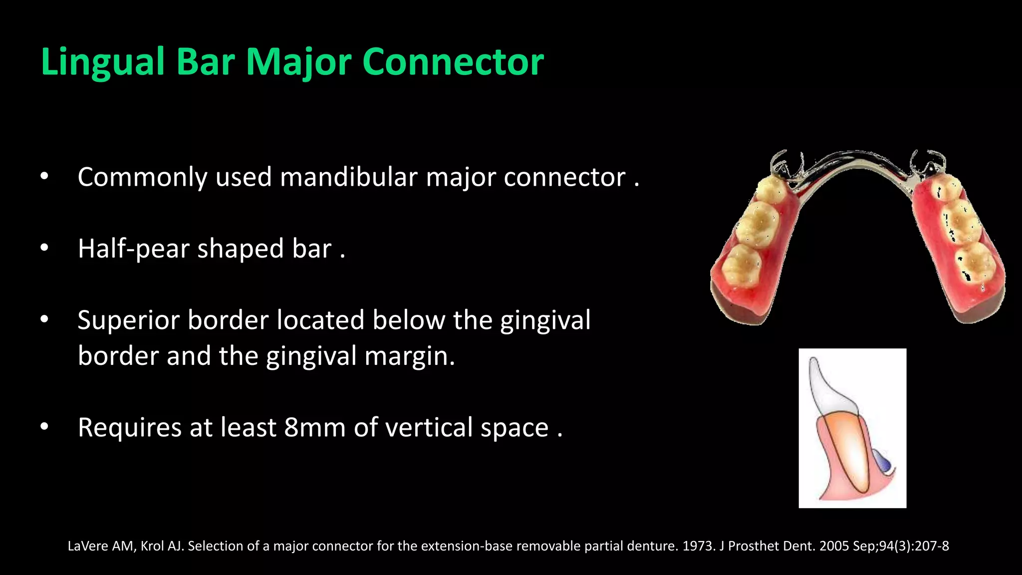 Connectors in RPD | PPTX