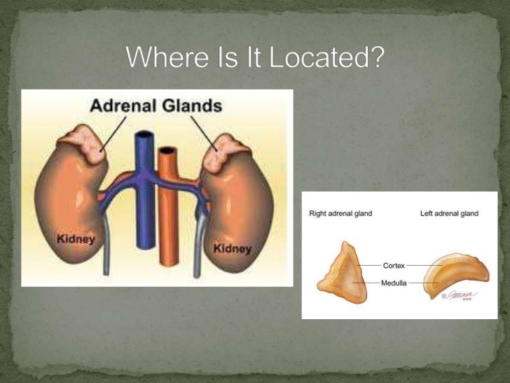 Conn’s syndrome group project