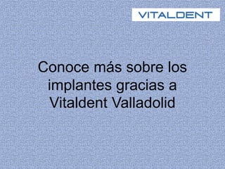 Conoce más sobre los
implantes gracias a
Vitaldent Valladolid
 