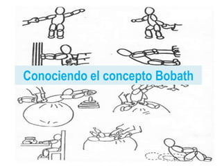 Conociendo el concepto Bobath
 