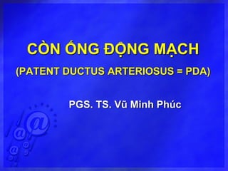CÒN ỐNG ĐỘNG MẠCH
(PATENT DUCTUS ARTERIOSUS = PDA)
PGS. TS. Vũ Minh Phúc
 