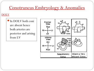 Conotruncal anamolies | PPT