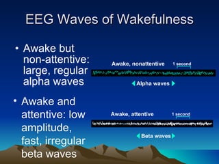 EEG Waves of Wakefulness Awake but non-attentive: large, regular alpha waves Awake and attentive: low amplitude, fast, irregular beta waves 1 second Alpha waves Awake,   nonattentive 1 second Beta waves Awake, attentive 