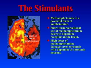 The Stimulants Methamphetamine is a powerful form of amphetamine. Short-term recreational use of methamphetamine destroys dopamine receptors in the brain. High doses of methamphetamine damages axon terminals with dopamine & serotonin neurons. 