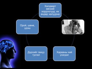 Халдварт 
өвчний 
хордлогууд, их 
өндөр халуурна 
Харааны хий 
үзэгдэл 
Орой, шөнө, 
Дүрсийг гажуу 
тусгал 
үдэш 
 