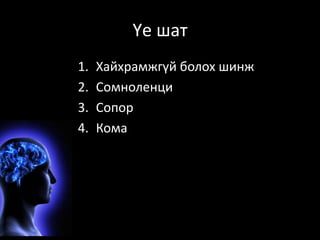 Үе шат 
1. Хайхрамжгүй болох шинж 
2. Сомноленци 
3. Сопор 
4. Кома 
 