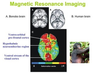 Magnetic Resonance Imaging   A. Bonobo brain B. Human brain Ventro-orbital pre-frontal cortex Ventral stream of the visual cortex Hypothalmic  neuroendocrine region 