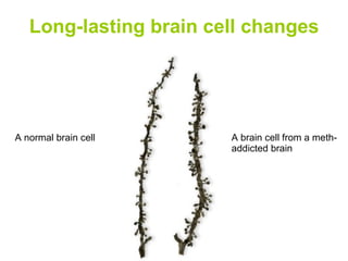 Long-lasting brain cell changes A normal brain cell A brain cell from a meth- addicted brain 