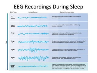 EEG Recordings During Sleep 5- 