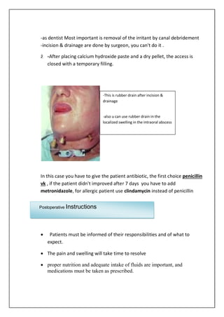 -as dentist Most important is removal of the irritant by canal debridement
-incision & drainage are done by surgeon, you can't do it .
ž -After placing calcium hydroxide paste and a dry pellet, the access is
closed with a temporary filling.
In this case you have to give the patient antibiotic, the first choice penicillin
vk , if the patient didn't improved after 7 days you have to add
metronidazole, for allergic patient use clindamycin instead of penicillin
 Patients must be informed of their responsibilities and of what to
expect.
 The pain and swelling will take time to resolve
 proper nutrition and adequate intake of fluids are important, and
medications must be taken as prescribed.
-This is rubber drain after incision &
drainage
-also u can use rubber drain in the
localized swelling in the intraoral abscess
Postoperative Instructions
 