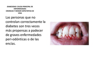 DIABESIDAD: CAUSA PRINCIPAL DE
ENFERMEDADES
CRONICAS Y MENOR EXPECTATIVA DE
VIDA
Las personas que no
controlan correctamente la
diabetes son tres veces
más propensas a padecer
de graves enfermedades
peri-odónticas o de las
encías.
 