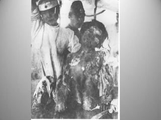 Consecuencias de la ii guerra mundial