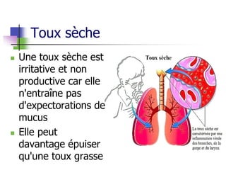 Toux sèche
 Une toux sèche est
irritative et non
productive car elle
n'entraîne pas
d'expectorations de
mucus
 Elle peut
davantage épuiser
qu'une toux grasse
 