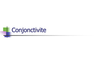 Conjonctivite
 