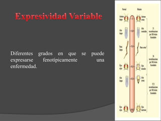 Diferentes grados en que se puede
expresarse fenotípicamente una
enfermedad.
 