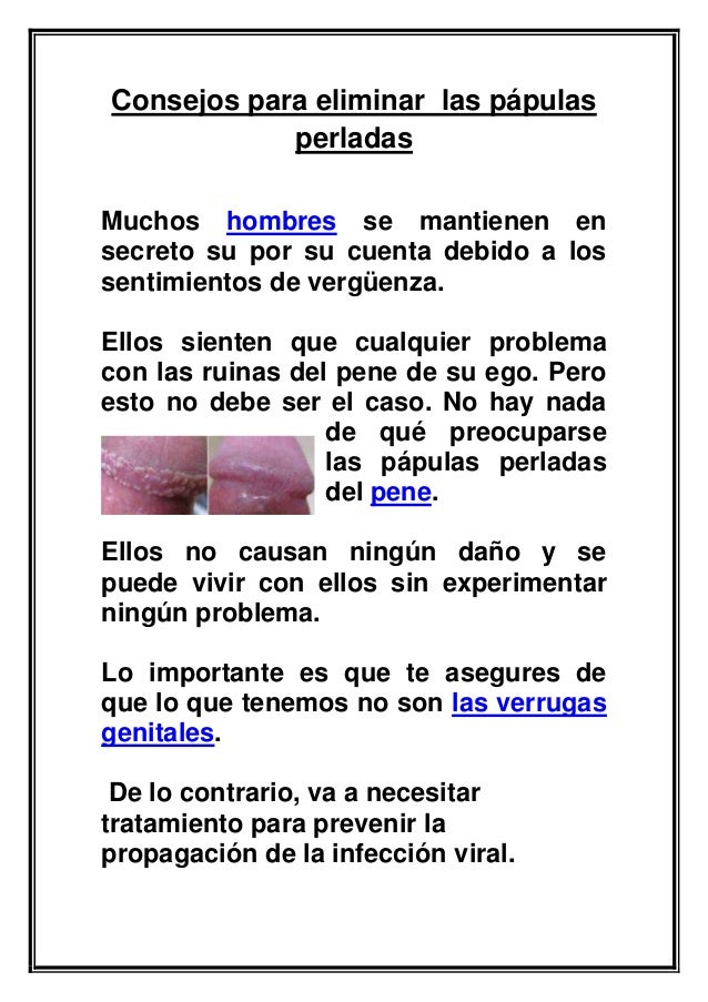 Consejos para eliminar las papulas perladas Consejos para eliminar las papulas perladas