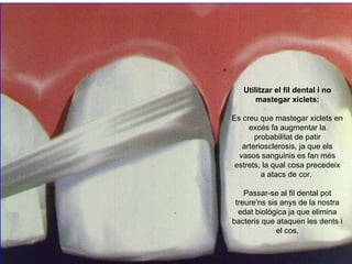 Utilitzar el fil dental i no mastegar xiclets : Es creu que mastegar xiclets en excés fa augmentar la probabilitat de pati...
