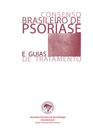 Sociedade Brasileira de Dermatologia
www.sbd.org.br
Afiliada à Associação Médica Brasileira
ConcensoPsoríase.qxd 28.08.06 09:20 Page I
 