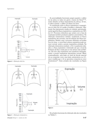 Espirometria




                                            As anormalidades funcionais surgem quando o calibre
                                         da via aérea se reduz em geral a menos de 8mm(34-36),
                                         sendo afetados os fluxos dependentes do esforço. O VEF1
                                         se altera quando o calibre cai abaixo de 5mm.
                                            A comparação entre os fluxos expiratórios e inspirató-
                                         rios no meio da CVF auxilia a localizar a obstrução. Obs-
                                         trução fixa tipicamente resulta em redução aproximada-
                                         mente igual dos fluxos inspiratórios e expiratórios em 50%
                                         da CVF. Processos obstrutivos que variam com a fase da
                                         respiração também produzem padrões característicos. Na
                                         obstrução extratorácica variável, usualmente os fluxos
                                         expiratórios são normais, mas há redução dos fluxos ins-
                                         piratórios. Devido a que o processo obstrutivo se localiza
                                         fora do tórax, a curva fluxo-volume expiratória pode pa-
                                         recer normal, sendo a porção inspiratória achatada. Na
                                         obstrução intratorácica variável, o PFE é usualmente redu-
                                         zido e o fluxo expiratório é diminuído até que o local da
                                         limitação de fluxo muda para as vias aéreas mais periféri-
                                         cas. Isto dá à alça expiratória uma aparência retangular,
                                         sendo a porção inspiratória tipicamente normal. Muito
                                         ocasionalmente, uma lesão ao nível da fúrcula esternal
                                         irá se comportar como uma lesão extratorácica na CPT,
                                         mas à medida que o VR se aproxima comporta-se como
Figura 4 – Obstrução alta fixa           intratorácica(37). Estes achados são mostrados na Figura
                                         6.




                                         Figura 6


                                           Os achados funcionais da obstrução alta são mostrados
Figura 5 – Obstrução intratorácica       na Tabela 1.
J Pneumol 28(Supl 3) – outubro de 2002                                                        S 47
 