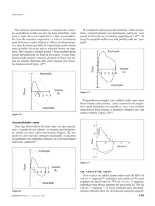 Espirometria




   Nas doenças neuromusculares, a fraqueza dos múscu-         O transplante pulmonar pode aumentar o fluxo expira-
los expiratórios resulta em pico de fluxo retardado, mais   tório, presumivelmente por denervação pulmonar, com
para o meio da curva expiratória, e algo arredondado.       perda do tônus broncoconstritor vagal (Figura 12)(44). Se
Ao final da manobra expiratória, a força é insuficiente     surgir bronquiolite obliterante este padrão pode ser “apa-
para deformar a caixa torácica e o fluxo cai abruptamen-    gado”.
te a zero. Lembrar que falta de colaboração pode simular
estes achados, de modo que os achados devem ser repe-
tidos. Em crianças e adultos jovens o fluxo também pode
cessar abruptamente ao final da expiração. A alça inspi-
ratória pode mostrar cessação abrupta do fluxo (ver aci-
ma) ou simular obstrução alta, pela fraqueza dos múscu-
los inspiratórios (Figura 10)(42).




                                                            Figura 12


                                                               Traqueobroncomegalia com malácia exibe uma curva
                                                            fluxo-volume característica, com a mesma forma expira-
                                                            tória geral observada em asmáticos, mas com entalhes
                                                            superpostos pelo colapso e posterior abertura das vias
                                                            aéreas centrais (Figura 13)(45).
Figura 10


Anormalidades raras
   Uma alça fluxo-volume de duas fases, em que um pul-
mão, ou parte de um pulmão, se esvazia mais lentamen-
te, resulta em uma curva característica (Figura 11). Isto
pode ser visto com um brônquio estenosado, ou quando
um paciente com enfisema submeteu-se a um transplante
pulmonar unilateral(43).




                                                            Figura 13



                                                            VEF1/CV(F)%  e VEF1/VEF6%
                                                              Uma criança ou adulto jovem expira mais de 80% da
                                                            CVF no 1o segundo(18); indivíduos com idade até 45 anos
                                                            expiram em geral mais de 75% da CVF no 1o segundo;
                                                            indivíduos mais idosos expiram em geral mais de 70% da
                                                            CVF no 1o segundo(17). A razão esperada para um deter-
Figura 11                                                   minado indivíduo deve ser derivada de equações específi-
J Pneumol 28(Supl 3) – outubro de 2002                                                                           S 49
 
