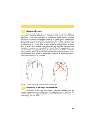 11
Calçados Adequados
Calçados inadequados são uma causa importante de ulceração. Calçados
adequados, adaptados às deformidades e às alterações biomecânicas, são essenciais á
prevenção. Os pacientes sem perda da sensibilidade podem escolher calçados
disponíveis no comércio. Um cuidado extra deve ser tomado para os pacientes com
neuropatia e/ou isquemia, particularmente quando as deformidades estão presentes.
O sapato não deve ser muito apertado nem muito folgado (veja figura4); a sua parte
interna deve ser de 1 a 2 cm maior do que o próprio pé; a largura interna do sapato
deve ser igual à do pé tomando como referência a face lateral das articulações dos
metatarsos, e a altura, com espaço suficiente para os dedos. Os calçados devem ser
experimentados com o paciente em pé, de preferência no final do dia. Se ticarem
muito apertados devido às deformidades ou se há sinais de pressão anormal do pé,
como hiperemia, calos, ulceração, a prescrição e confecção de palmilhas ou órteses,
sapatos especiais devem ser efetuadas.
Fig 4. A largura interna do sapato deve ser igual à do pé.
Tratamento de patologia não ulcerativa
Em pacientes de alto risco, calos, unhas e patologias cutâneas devem ser
tratadas regularmente, de preferência por um especialista em pé diabético. As
deformidades dos pés, se possível, devem ser tratadas de forma conservadora, usual,
sem cirurgia, com uma órtese.
 
