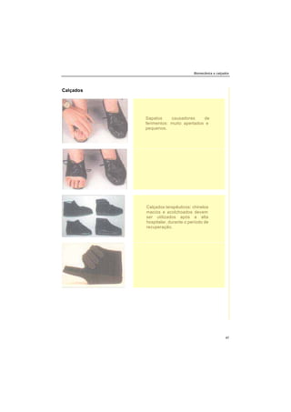 Biomecânica e calçados
47
Calçados
Sapatos causadores de
ferimentos: muito apertados e
pequenos.
Calçados terapêuticos: chinelos
macios e acolchoados devem
ser utilizados após a alta
hospitalar, durante o período de
recuperação.
 