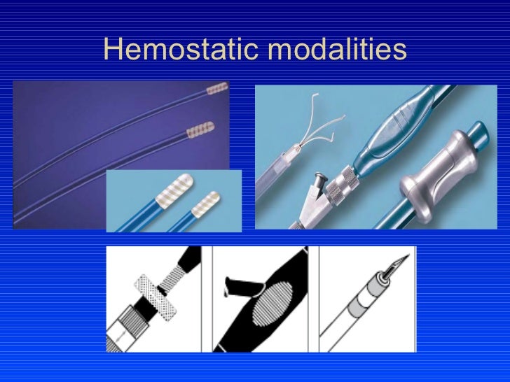 Consensus approach to upper gi b
