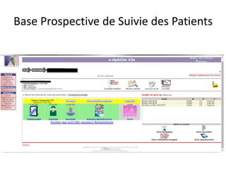 Base Prospective de Suivie des Patients