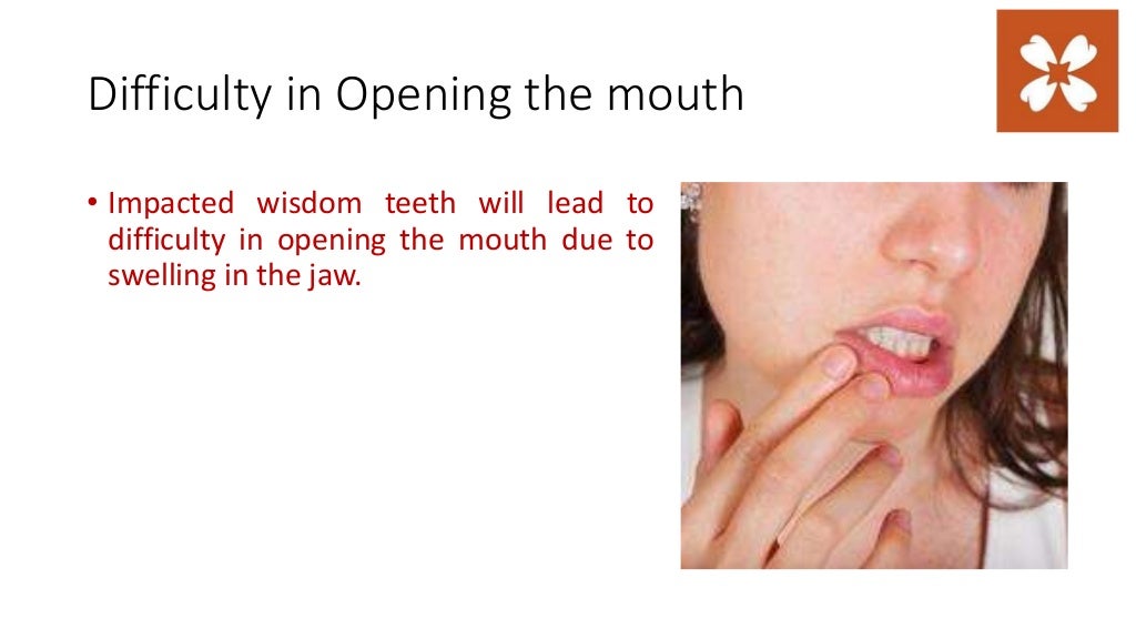 Consequences of impacted wisdom teeth