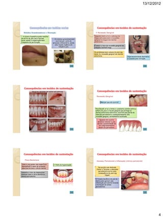 13/12/2012




                                                                        Recessão Gengival

 A ulcera traumática pode resultar                                  Segundo Canto et al, o adereço na
do atrito da jóia com a mucosa                                       língua esta associado à recessões
                                       Os nódulos granulomatosos
bucal, sendo a complicação mais                                      gengival na lingual dos dentes
                                         ocorrem por conta do        anteriores.
frequente de perfuração.              processo inflamatório, sendo
                                        uma reação orgânica em
                                                                     É maior o risco de recessão gengival em
                                             relação à joia.
                                                                     relação a barbell longa.

                                                                     Os problemas mais comuns do piercing
                                                                     labial, é a recessão gengival nos dentes
                                                                     anteriores.                                   Hipersensibilidade dentinária
                                                                                                                   é causada pela retração.




                                                                        Recessão Gengival


                                                                              Mas por que ela ocorre?



                                                                       Para Bozelli et al, o íntimo e constante contato entre a
                                                                       esfera da joia e o tecido gengival que protege os
                                                                       dentes anteriores inferiores, acarreta uma perda de
                                                                       inserção periodontal e consequentemente uma
                                                                       recessão gengival, normalmente localizada.

                                                                           Quando isto ocorre
                                                                         devemos remover a joia,
                                                                         devido a possibilidade de
                                                                          um comprometimento
                                                                          severo do periodonto.




    Placa Bacteriana
                                                                        Abcesso Periodontal e Inflamação crônica periodontal
Como a joia possui uma superficie       Falta de higienização
descamavél é capaz de acumular
placa bacteriana e cálculo dental.                                        De acordo com Andrade,
                                                                        Junior e Terezan, o abscesso
                                                                          periodontal ocorre como
Aumenta o risco de desenvolver                                            consequência do piercing
doenças como a cárie dentária e                                                    lingual.
doença periodontal.
                                                                       O trauma mecânico da joia no
                                                                       dente pode agravar uma
                                                                       inflamação periodontal levando
                                                                       a formação de bolsas
                                                                       periodontais.




                                                                                                                                                   4
 
