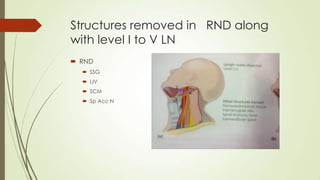 Structures removed in RND along
with level I to V LN
 RND
 SSG
 IJV
 SCM
 Sp Acc N
 