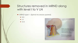 Structures removed in MRND along
with level I to V LN
 MRND type I – (Spinal Accessory spared)
 SSG
 IJV
 SCM
 