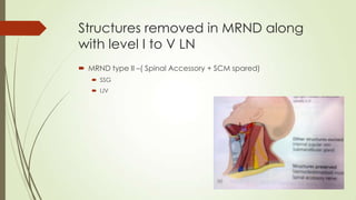 Structures removed in MRND along
with level I to V LN
 MRND type II –( Spinal Accessory + SCM spared)
 SSG
 IJV
 