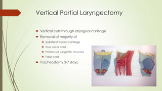 Vertical Partial Laryngectomy
 Vertical cuts through laryngeal cartilage
 Removal of majority of
 Ipsilateral thyroid cartilage
 True vocal cord
 Portions of subglottic mucosa
 False cord
 Tracheostomy 3-7 days.
 