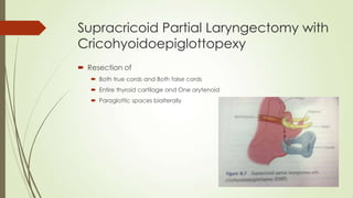 Supracricoid Partial Laryngectomy with
Cricohyoidoepiglottopexy
 Resection of
 Both true cords and Both false cords
 Entire thyroid cartilage and One arytenoid
 Paraglottic spaces bialterally
 