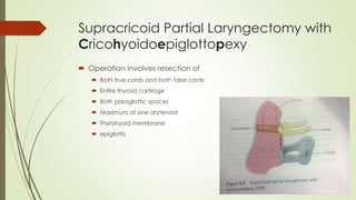 Supracricoid Partial Laryngectomy with
Cricohyoidoepiglottopexy
 Operation involves resection of
 Both true cords and both false cords
 Entire thyroid cartilage
 Both paraglottic spaces
 Maximum of one arytenoid
 Thyrohyoid membrane
 epiglottis
 